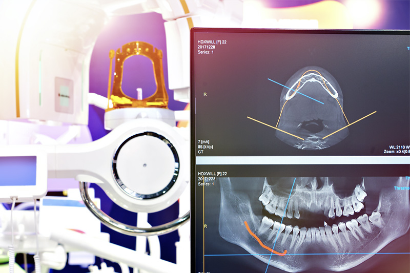 Digital X-Rays in Cypress